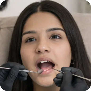 Cavity prevention with pit and fissure sealant at home