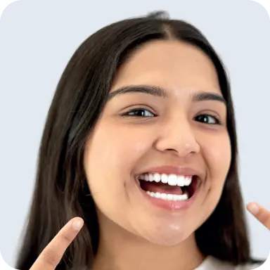 Teeth whitening image